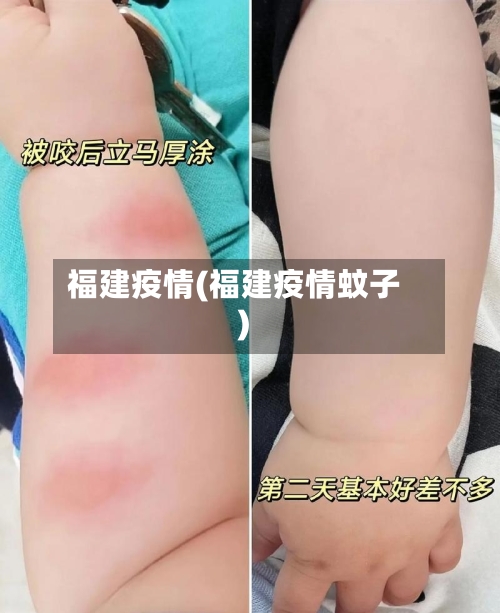 福建疫情(福建疫情蚊子)